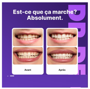 Tiras blanqueadoras dentales (box2)