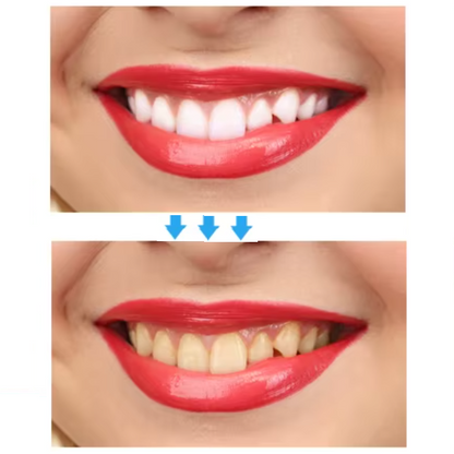 Tiras blanqueadoras dentales (box2)