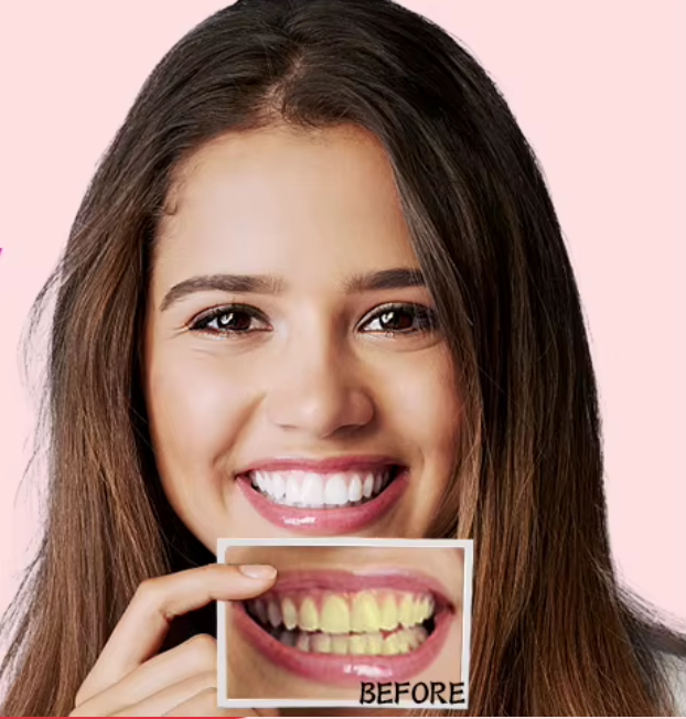 Tiras blanqueadoras dentales (box2)