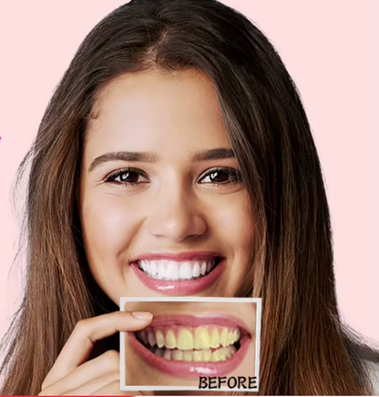 Tiras blanqueadoras dentales (box2)