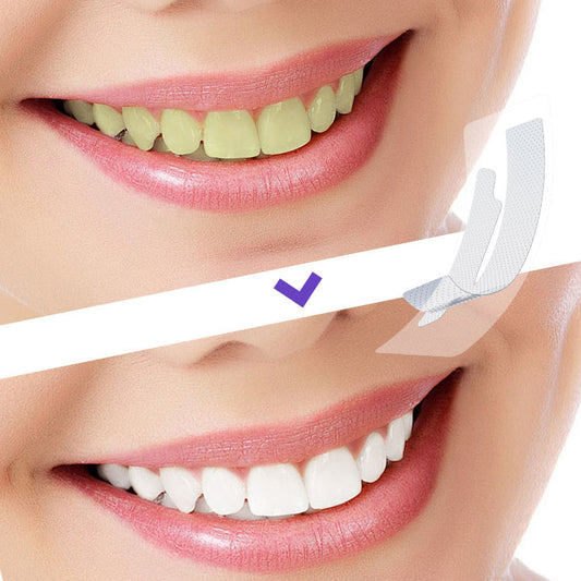 Bandas Blanqueadoras Dentales (caja de 4)